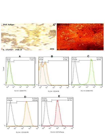 An Inexpensive and Simple Method for Isolation Mesenchymal Stem Cell of Human Amnion Membrane 